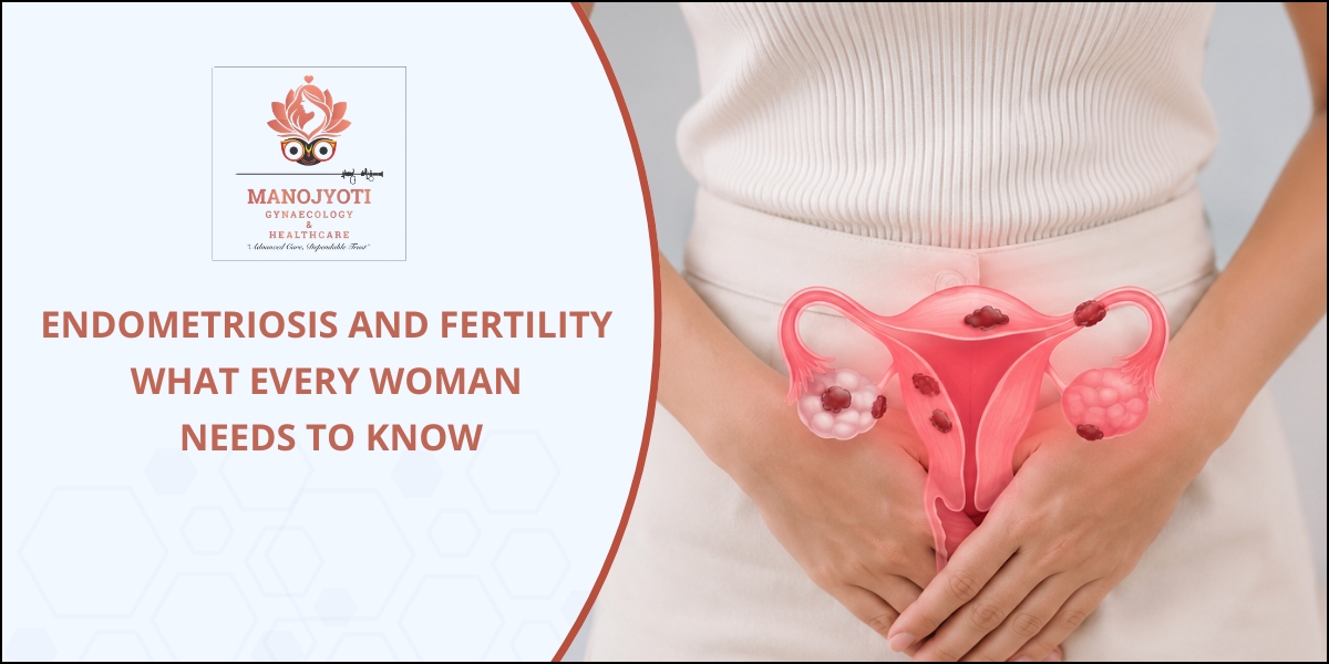 Endometriosis and Fertility What Every Woman Needs to Know